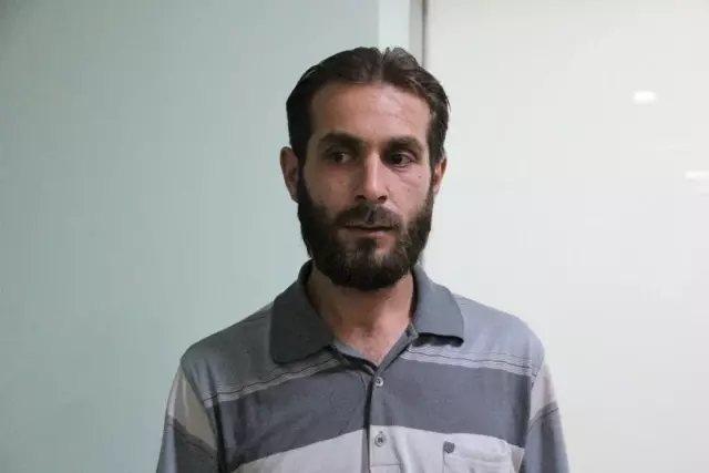 Suriye'de Doğan Çift Başlı Bebek, Türkiye'ye Getirildi