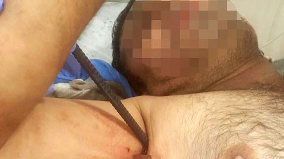 İnşaattan Düşen İşçi 3 Santimetreyle Hayata Tutundu