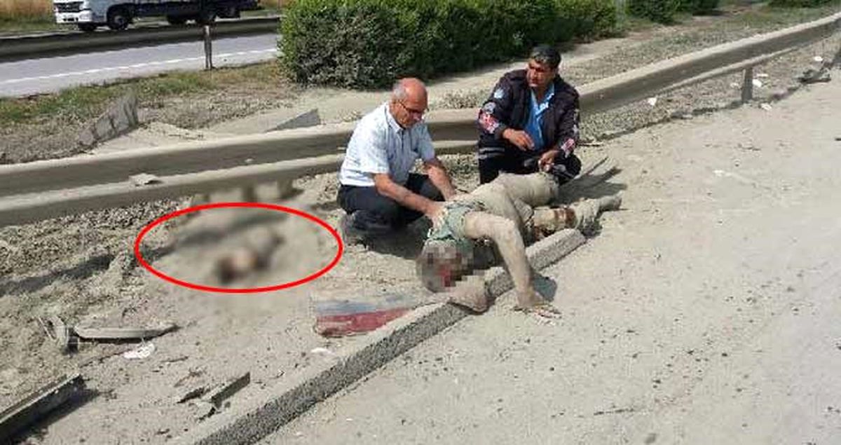 Talihsiz Sürücü, Kopan Bacağının Yanında Yardım Bekledi