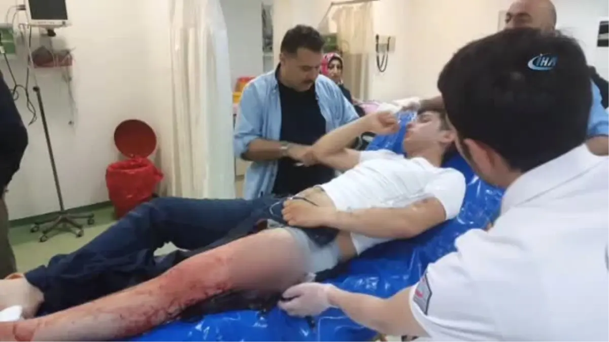Bacağına Saplanan Bıçakla Hastaneye Kaldırıldı