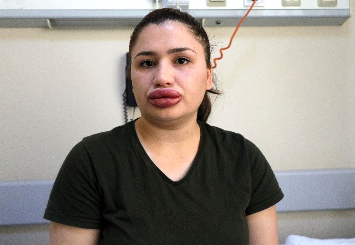 Merve Hemşireyi Mağdur Eden Sahte Estetikçi Kuaföre 5 Yıla Kadar Hapis İstendi