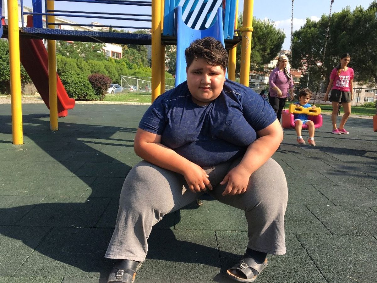 10 Yaşında 165 Kilo Olan Nurettin, Ameliyat Olmazsa Ölebilir
