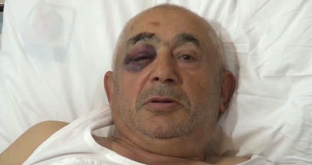 Erzincan'da Mantar Toplayan Kuzenlere Ayı Saldırdı
