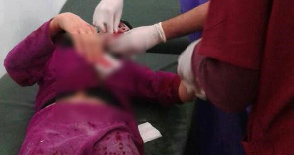 TSK Açıkladı: PYD, Mare'de Sivilleri Vurdu! 4 Ölü, 20 Yaralı