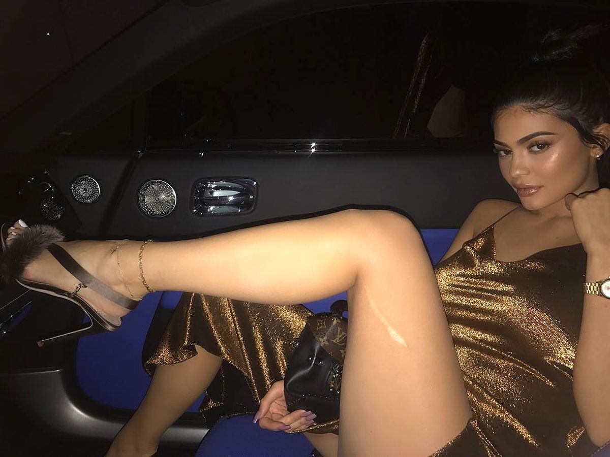 Kylie Jenner, Yara İzini Göstermek İçin Bacağını Açtı