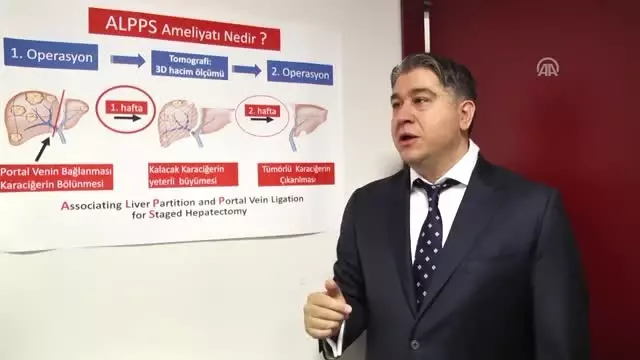 Karaciğer Kanseri Hastalarına Yeni Yöntem Umut Oldu Karaciğer Kanseri Hastalarına Yeni Yöntem Umut Oldu