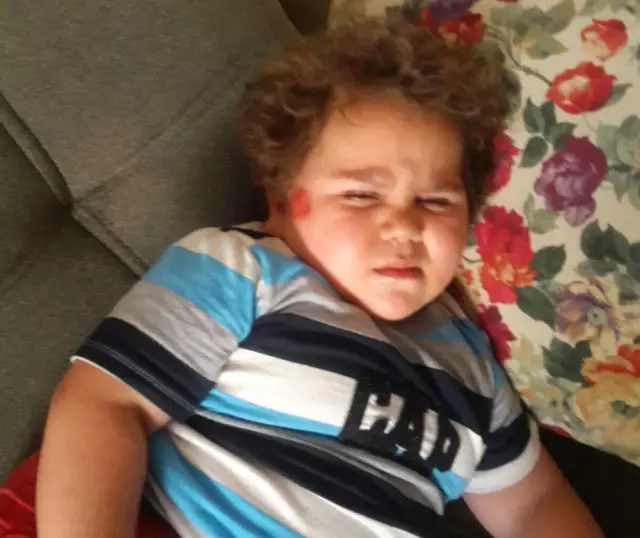 Minik Fenomen &quot;Çitos Efe&quot; Kaza Geçirdi Haberler