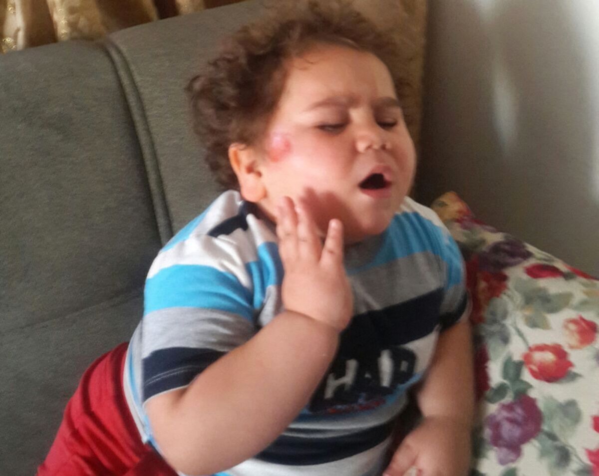 Minik Fenomen 'Çitos Efe' Kaza Geçirdi