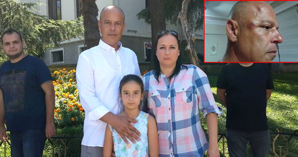 1 Yıldır Adalet Arıyor: Komşu Kavgasını Ayırınca Kızının Önünde Öldüresiye Dayak Yedi!
