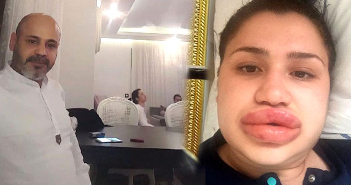 Silikon Mağduru Merve Hemşireye Mahkemede Şok Suçlama