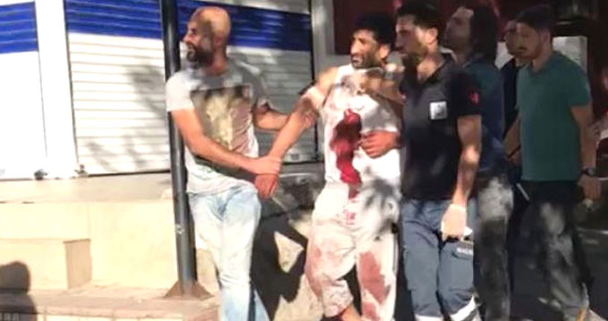 Eşini ve Kızını Yaralayan Baba 1.5 Saat Sonra Polise Teslim Oldu