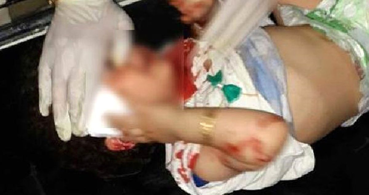 PYD/YPG Azez'de Sivillere Top ve Havanla Saldırdı: 2 Ölü, 4 Yaralı
