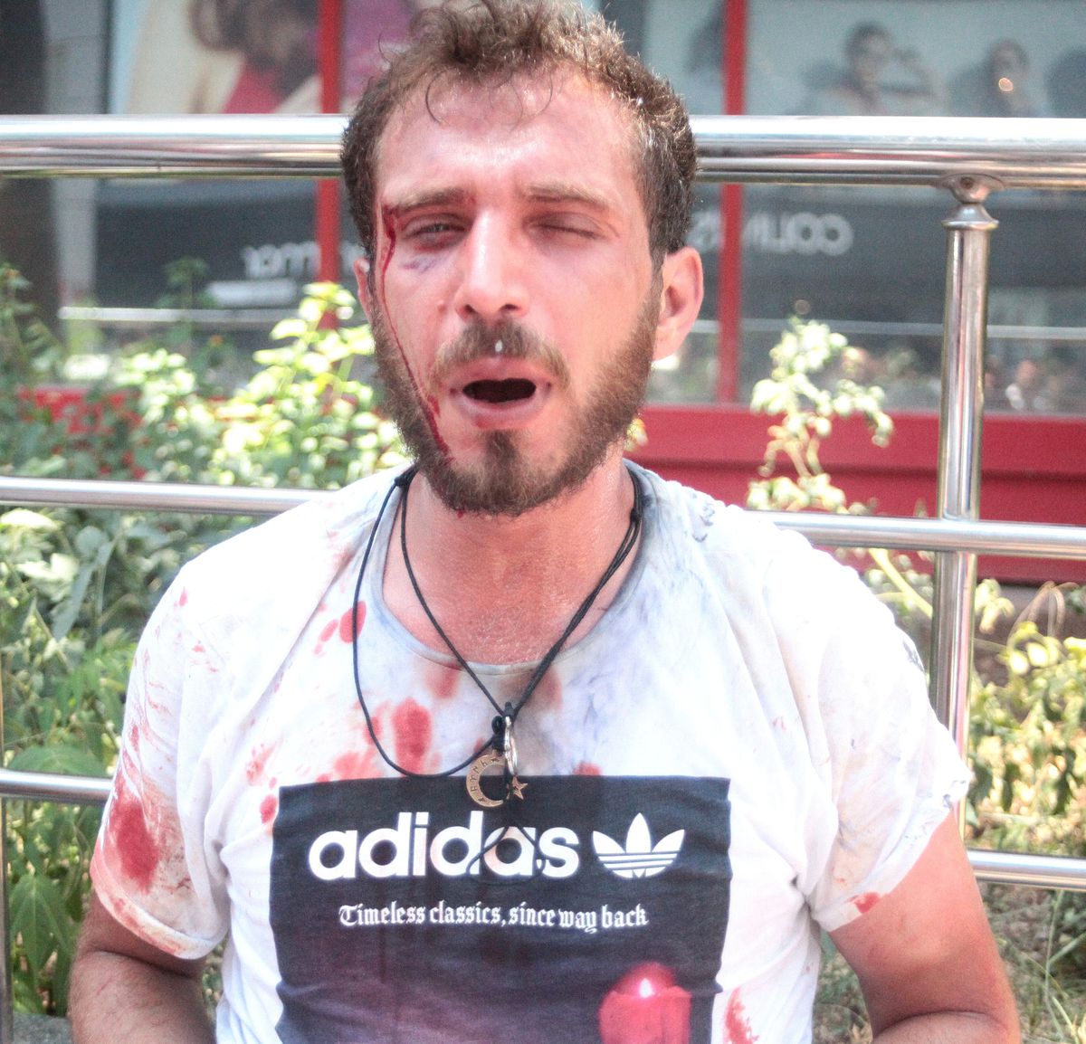 Seyyar Satıcılarla Zabıtaların Kavgasını Polis Güçlükle Ayırdı: 2 Yaralı