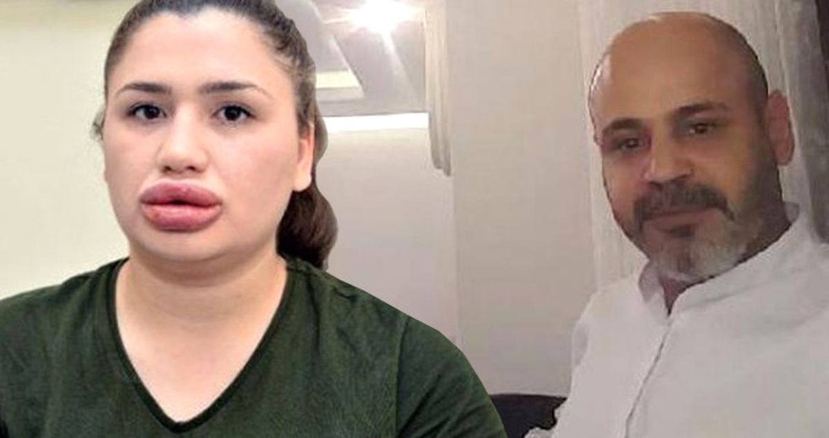 17 Yılla Yargılanan Sahte Estetikçi Tahliye Edildi