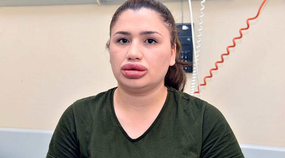 Adana'daki 'Sahte Estetikçi' Kuaför, Cezaevinden Kaçtı