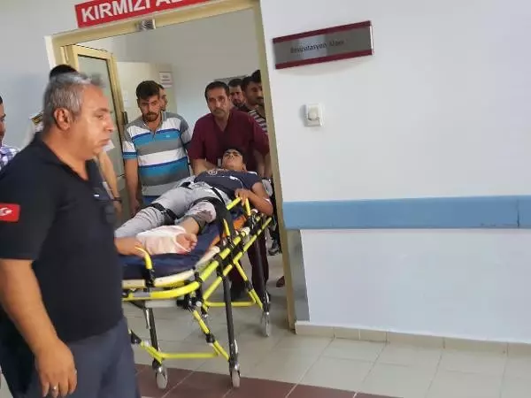 Motosiklet Kazasında Ayağı Koptu
