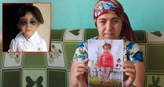 Karabük'te Üvey Annesi Tarafından Darp Edilen Çocuğun Öz Annesi Konuştu!
