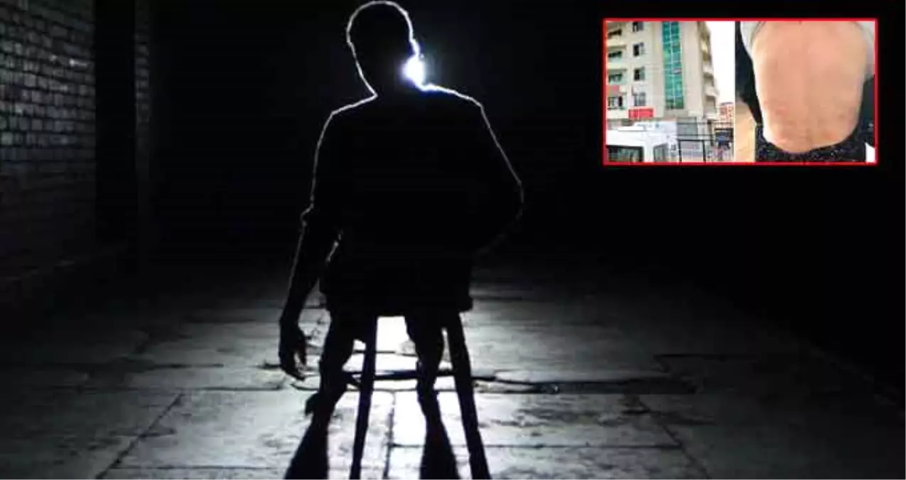 Konya'daki Bakımevinde Dehşet: Hastaları Dövüp Üzerlerinde Sigara Söndürdüler