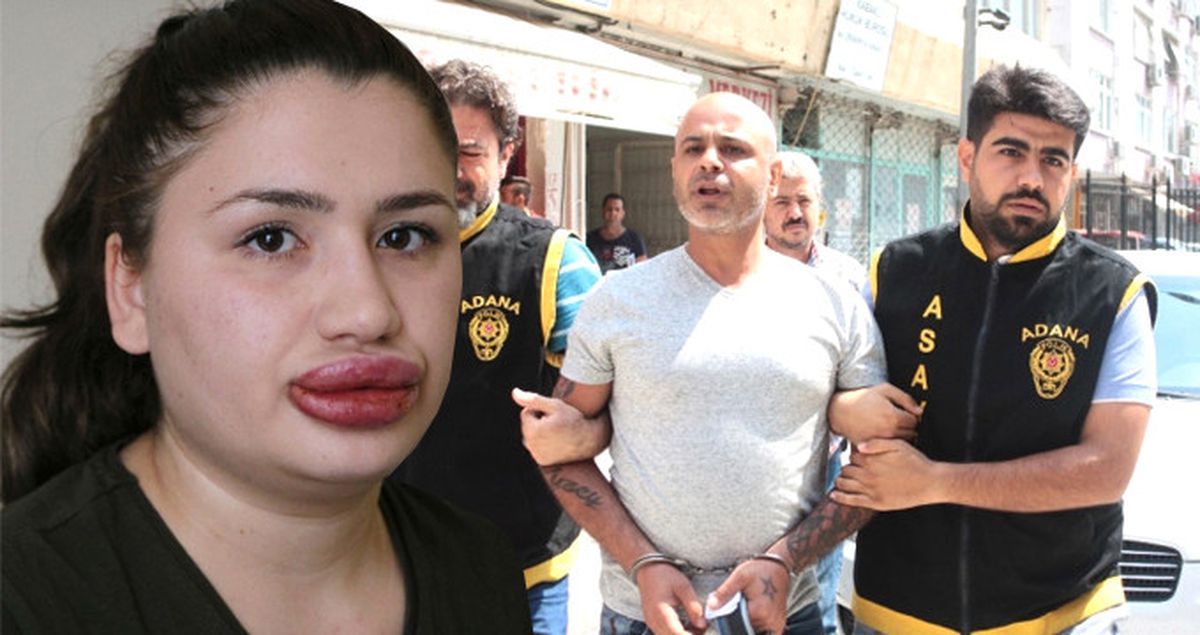 Cezaevinden Firar Eden Sahte Estetikçi, Yunanistan'a Kaçamadan Yakalandı