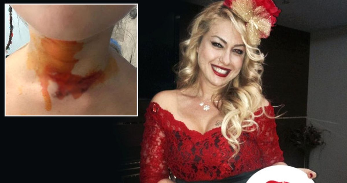 Yeliz Yeşilmen, Yemek Yemeğe Gittiği Mekanda Dehşeti Yaşadı