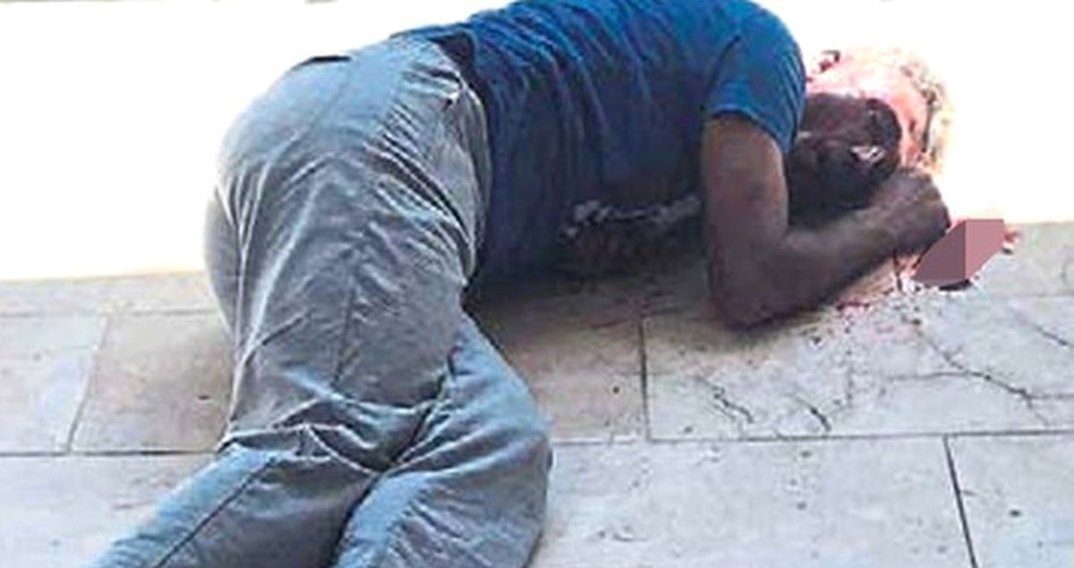 Down Sendromlu Kızı Taciz Eden Sapık, Öldüresiye Dayak Yedi