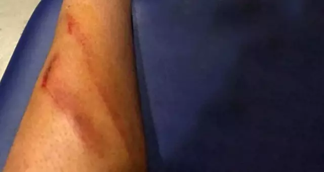Malatyasporlu Futbolcu, Maçın Hakemine Bacağının Fotoğrafıyla Çattı