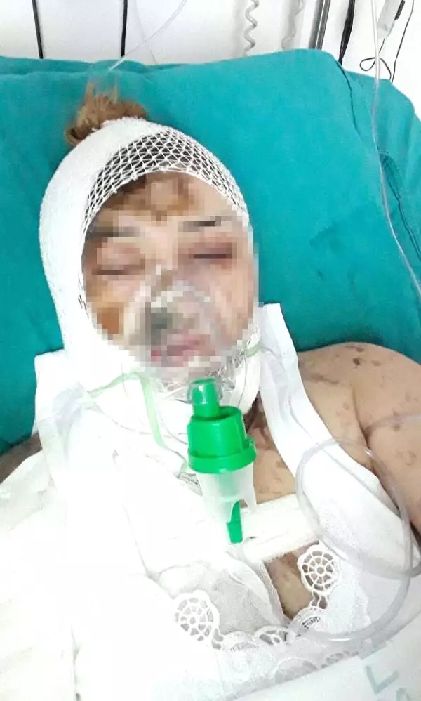 Savcı İtiraz Etti, Kezzap Atıp Serbest Kalan Saldırgan Gözaltına Alındı