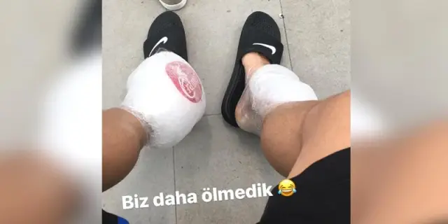 Deportivolu Emre Çolak, Instagram'dan Ayağının Son Halini Paylaştı