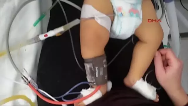 İzmir Yaşaması Karaciğer Nakline Bağlı