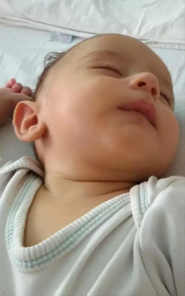 7 Aylık Hüseyin'in Yaşaması İçin Acilen Karaciğer Nakli Gerekiyor!