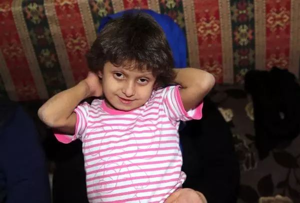 Anne Kizi Icin 10 Kilo Zayiflayarak Karacigerini Verecek Rize
