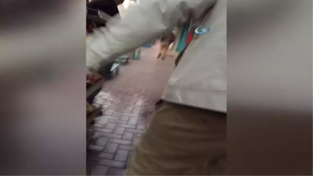 Yüzüne Kimyasal Madde Atılan Kadının Durumu İyiye Gidiyor