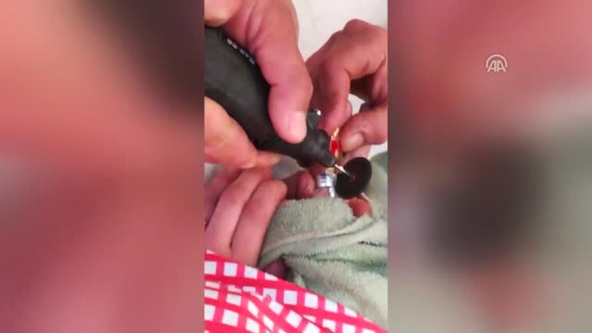 Parmağına Sıkışan Alyansı İtfaiye Çıkardı