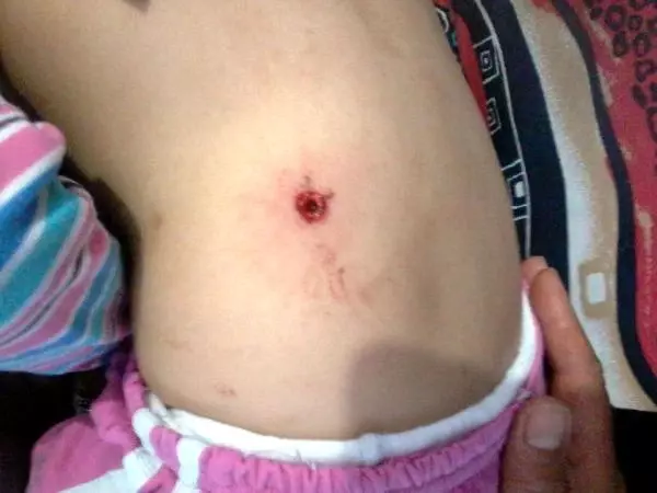 2 Çocuğu Vurduğu Silah 'Öldürmeye Elverişsiz' Çıktı, 7,5 Yıl Hapis Cezası Aldı 2 Çocuğu Vurduğu Silah 'Öldürmeye Elverişsiz' Çıktı, 7,5 Yıl Hapis Cezası Aldı