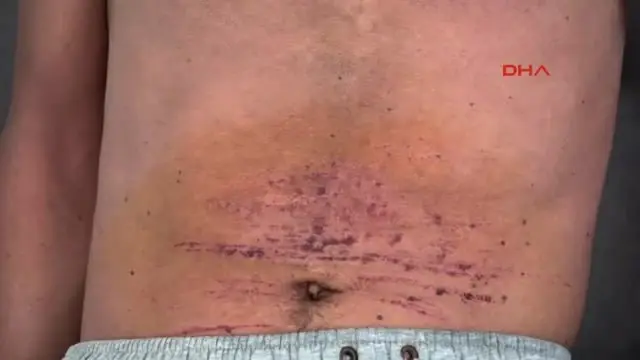 Bodrum Başına Çuval Geçirdikleri Engelli Genci Dövüp, Yaraladılar 1- Bodrum Başına Çuval Geçirdikleri Engelli Genci Dövüp, Yaraladılar 1-
