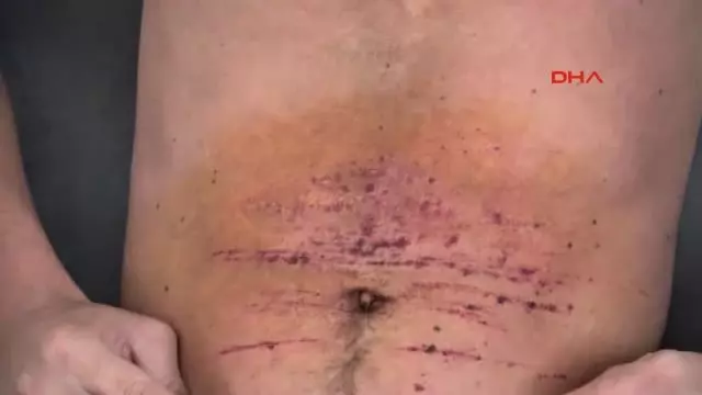 Bodrum Başına Çuval Geçirdikleri Engelli Genci Dövüp, Yaraladılar 1- Bodrum Başına Çuval Geçirdikleri Engelli Genci Dövüp, Yaraladılar 1-