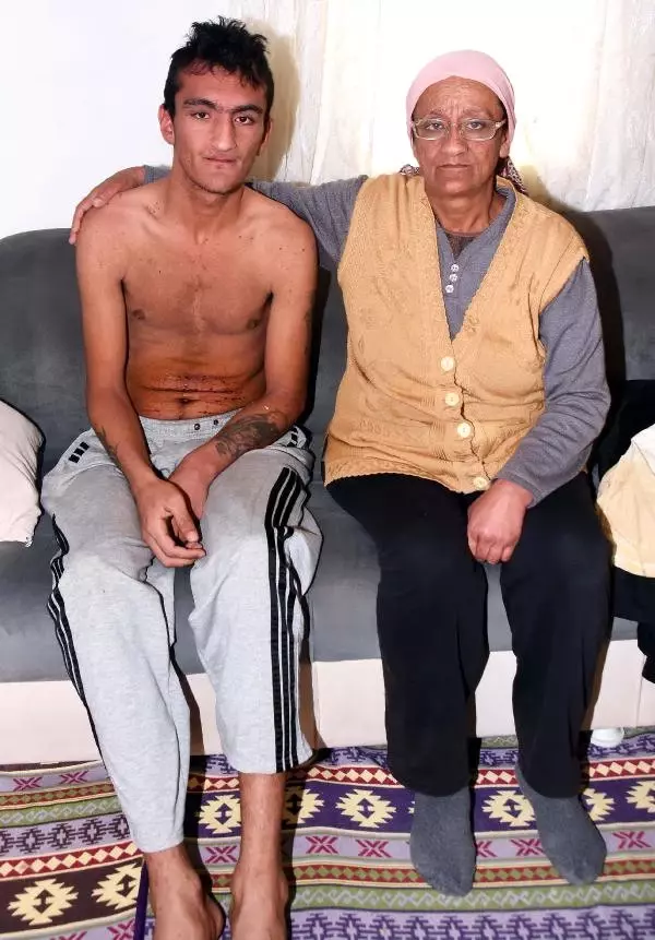 Engelli Genci Başına Çuval Geçirip Dövdüler, Bıçakla Yaraladılar Engelli Genci Başına Çuval Geçirip Dövdüler, Bıçakla Yaraladılar