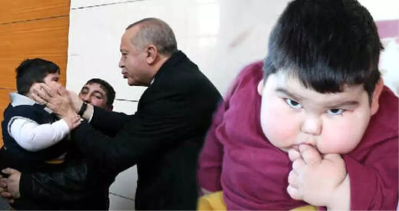2 Yasinda 29 Kilo Olan Cocuk Cumhurbaskani Erdogan La Bulustu Haberler