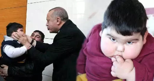 2 Yasinda 29 Kilo Olan Cocuk Cumhurbaskani Erdogan La Bulustu Haberler