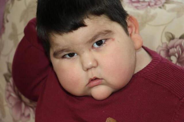2 Yasinda 29 Kilo Olan Cocuk Cumhurbaskani Erdogan La Bulustu Haberler
