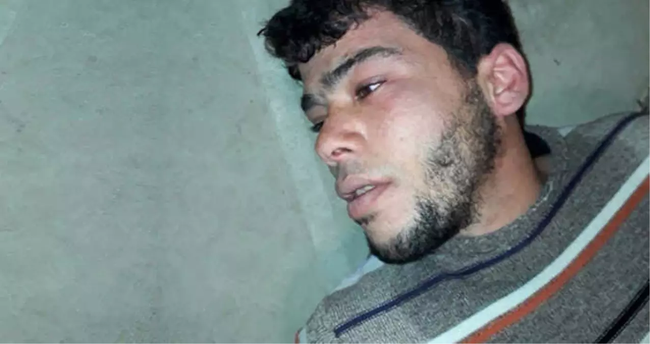 PKK/YPG kimyasal gazla saldırdı ile ilgili görsel sonucu
