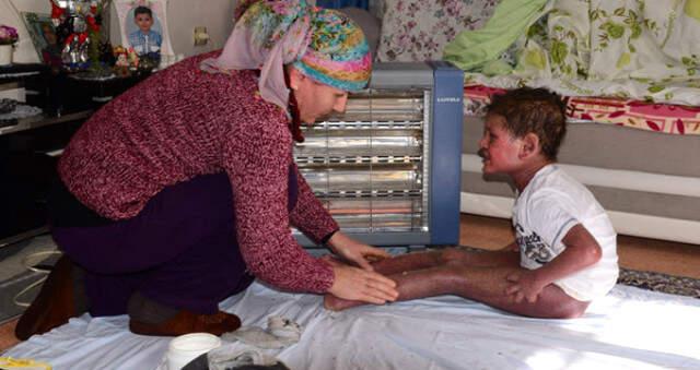 Hiç Durmadan Kaşınan Çocuğun Feryadı: Ölmek İstiyorum Anne