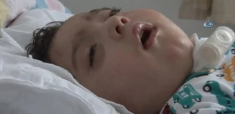 Havale Geçirip Yatağa Mahkum Olan Bebek, Kurtulmak İçin 1 Milyon TL'lik Ameliyat Bekliyor