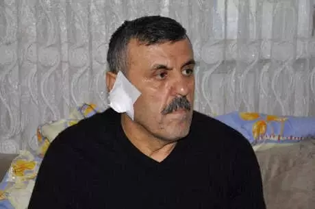 65 Bin liralık Alacağını İsteyince Kavga Çıktı, Talihsiz Adamın Kulağı Isırılarak Koparıldı 65 Bin liralık Alacağını İsteyince Kavga Çıktı, Talihsiz Adamın Kulağı Isırılarak Koparıldı