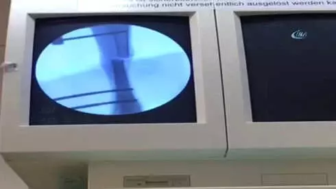 Türk Doktordan İnanılmaz Buluş... 'Doktor Robot' Türk Doktordan İnanılmaz Buluş... 'Doktor Robot'