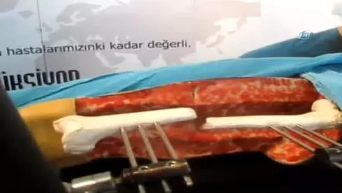 Türk Doktordan İnanılmaz Buluş... 'Doktor Robot'