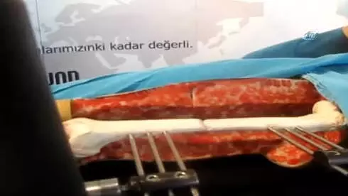 Türk Doktordan İnanılmaz Buluş... 'Doktor Robot'
