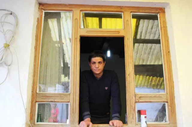 Yüzüne Gelen Meşale Hayatını Kararttı Yüzüne Gelen Meşale Hayatını Kararttı