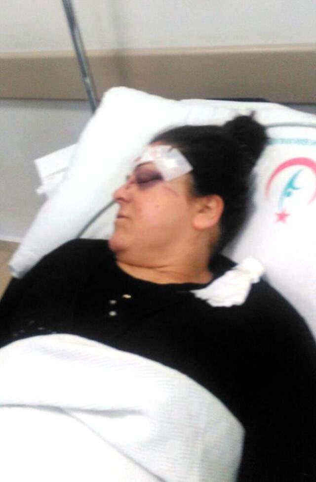 Cani Koca, Boşanma Davası Açan Karısına Tornavida ile Saldırdı