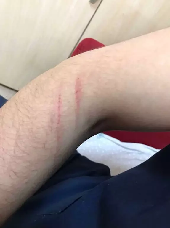 Şırnak'ta Darp Edilen Sağlık Çalışanına Yönelik Saldırı Kınandı Şırnak'ta Darp Edilen Sağlık Çalışanına Yönelik Saldırı Kınandı